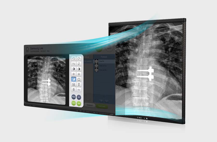 邦楽 X-RAY GR40CW Radiography Retrofit | Samsung Healthcare